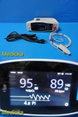 Monitor Masimo Radical 7 Touch SpO2 2013 con base RDS-1 y sensor SpO2 ~ 32192 Foto 1 de 4