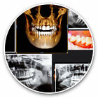 2 x Vinyl Stickers 30cm - 3D Dental X-Ray Dentist Cool Gift #21052