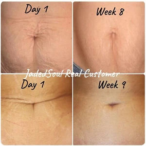 Wrinkle Restore Belly Anti-Aging Age Perfect Origina Jaded Soul Tighter Skin - Picture 1 of 7
