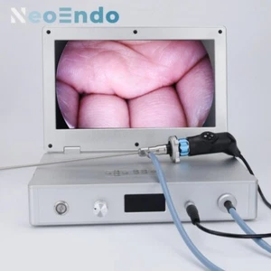 HD Portable Medical Endoscope Camera With 15.6 Inch Monitor 80W Light Source - Picture 1 of 16