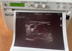 Sony UP-D898 MD Ultraschalldrucker ultrasound printer  - Bild 1 von 3