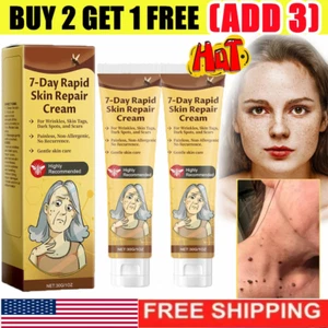 Crema rápida para la piel de 7 días, 1 OZ crema reparadora rápida de la piel de 7 días - Imagen 1 de 14