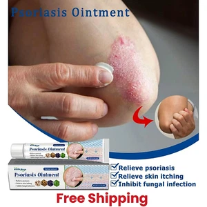 Psoriasis Dermatitis Eczema Natural Cream Skin Treatment Ointment FREE SHIPPING - Picture 1 of 9