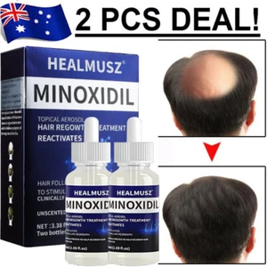 Minoxidil 5% Extra Strength Men Hair Regrowth Treatment 2 Month Supply Solution - Picture 1 of 18