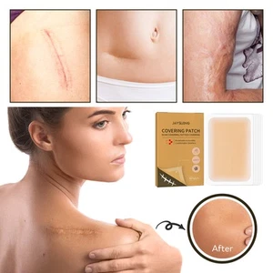Invisible Concealer Skin Mask for Tattoo Scar Spots Silica & Hydrogel Waterproof - Picture 1 of 5