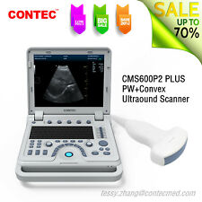CONTEC CMS600P2 PLUS Ultrasound Scanner PW Diagnostic Systems with Convex Probe