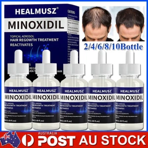 Minoxidil 5% Extra Strength Men Hair Regrowth Treatment 6 Month Supply 50ml - Picture 1 of 26