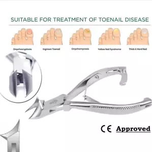 CHIROPODY TOE NAIL Tagliaunghie per Unghie Incarnite Funghi Spessi Resistenti - Foto 1 di 4