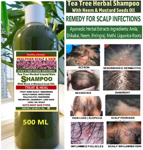 STOP ITCHY SORE SCALP FAST Tea Tree Herbal Antiseptic Liquid Shampoo 500 ML - Picture 1 of 11