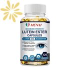 Extrait de myrtille vitamines pour les yeux lutéine zéaxanthine, soulagement de la fatigue oculaire vision santé