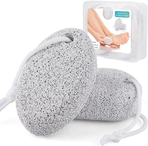 2 Piedra Pomez Exfoliantes Para Pies Manos Piernas Removedor Callos Piel Agrietada - Imagen 1 de 8
