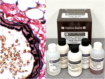 Kit de manchas de elastina VitroView™ Verhoeff Van Gieson (Cat# VB-3019) Foto 1 de 4