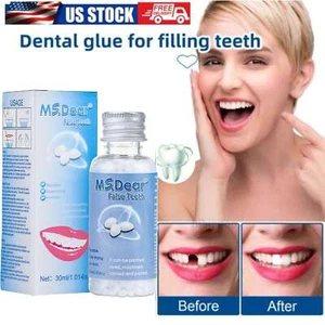 Tooth Repair Granules Temporary Kit Fitting Beads Reusable Moldable False Teeth - Picture 1 of 17