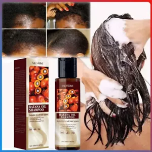 100ml Batana Oil Shampoo For Hair Growth Healthier Thicker Fuller Anti Hair Loss - Picture 1 of 18