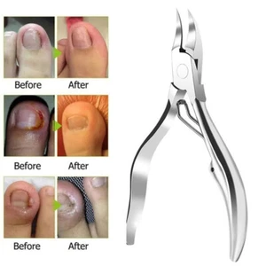 Cuticle Scissors Pedicure Nail Ingrown Nipper Toenail Cutter Dead Skin Remove - Picture 1 of 17
