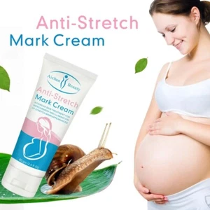 Pregnancy Scar Repair Cream Stretch Marks Removal Fat Stretch Mark Treatment NEW - Picture 1 of 11