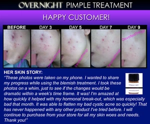 6+ Before and After pics Best Boils, Acne, Pimple, Zits, Blemish Removal Remover - Picture 1 of 7