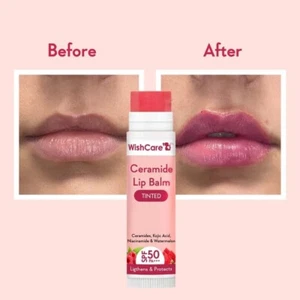WishCare Tinted Ceramide Lip Balm with SPF50 PA+++ - Kojic Acid & Niacinamide - - Picture 1 of 6