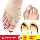 Bunion Corrector Big Toe Splint Straightener Hallux Valgus Foot Separator Hammer