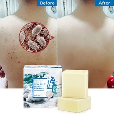 100g Sea Salt Soap Pimple Acne Treatment Goat Milk Moisturizing Face Wash Soap