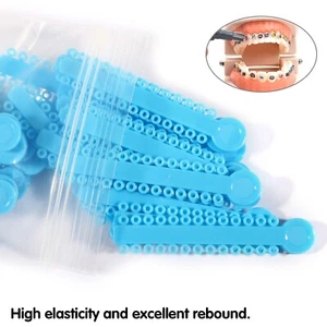 1040 Pcs Dental Orthodontic Ligature Ties Elastic Braces Rubber Bands blue #2 - Picture 1 of 11