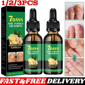 Ginger Nail Treatment Nail Care, Nail Growth Oil for Cuticle Nourishment ~~ - Picture 1 of 13