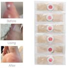Foot Corn Remover Pads Adhesive Bandage Hole Over 16 Years Old Wart Thorn
