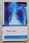 Pocket Guide To Chest  X-Rays By Greg Briggs