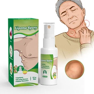 Lipoma Removal Spray 30ml Herbal Skin Swelling Exfoliating Pain - Picture 1 of 12