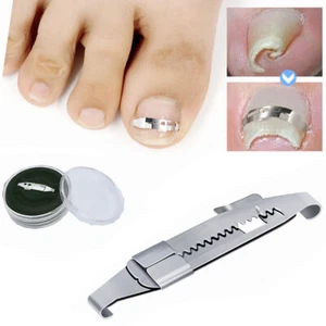 Professional Ingrown Toenail Straightener Paronychia Correction Pedicure Tools , - Picture 1 of 8