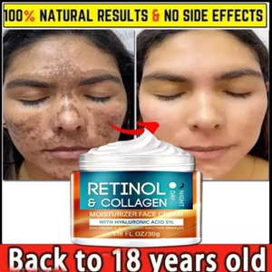Retinol Cream For Wrinkles & Skin Tightening Cream 30gm ( Free Ship ) - Picture 1 of 10