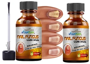ANTIFUNGAL  Support ANTI FUNGAL EXTRA STRENGTH TOENAIL FUNGUS ATHLETE'S FOOT 2  - Picture 1 of 11