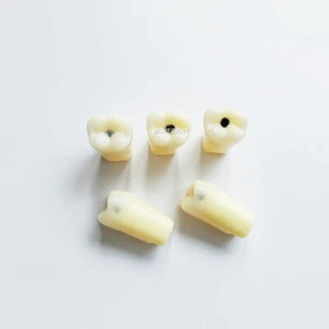 Dental Molar Vitro Teeth Decay Caries Screw Model Dentist Tooth Student #36 - Picture 1 of 9