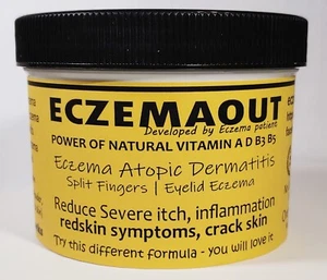 Intense Treatment Cream for Eczema Rosacea Dermatitis Rash 10 oz - Picture 1 of 12