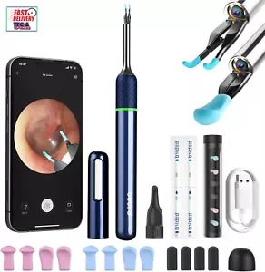 Ear Camera Wax Removal, Note 5 Ear Wax Removal Tool Camera Ear Tweezers with Ca - Picture 1 of 12