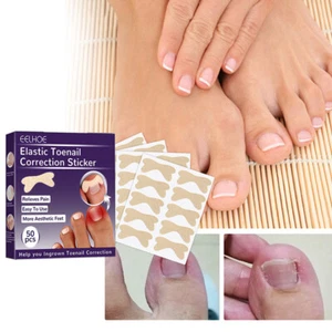50Pcs Ingrown Toenail Corrector Sticker Nail Strip Corrector Stick-C9 - Picture 1 of 9