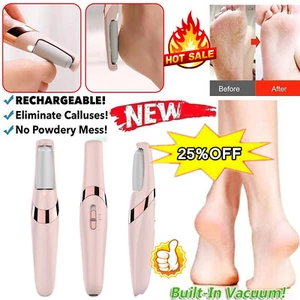Electric Foot Dead Skin Grinder Feet Grinding File Callus Remover Pedicure Tool - Picture 1 of 16