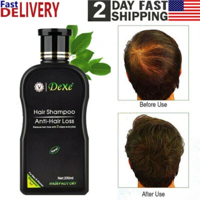 DEXE Anti-Hair Loss Shampoo Chinese Herbal Hair Regrowth For Men & Women 200ml - Image 1 of 4