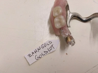 Zahngold  Zahnprothese Oberkiefer Goldlot Gold - Bild 1 von 4