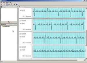 Omron HCG-801 Heartscan Ecg Software Extension Paquet (No Moniteur) - Picture 1 of 1