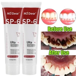 2x Sp-6 Probiotic Whitening Toothpaste Brightening Remove Bad Breath Toothpaste - Picture 1 of 13
