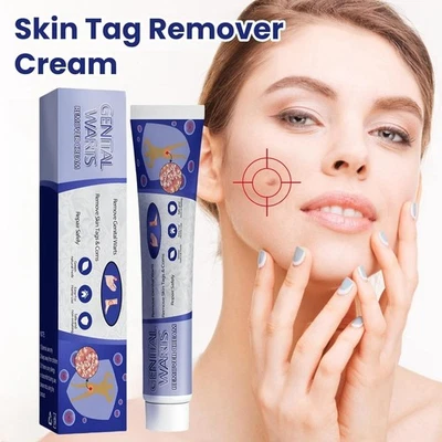 Skin Tag Mole Wart Remover Removal Cream Ointment Fast Safe Natural Treatment