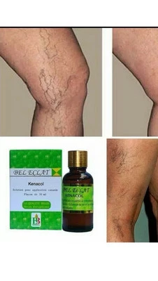 BEL ECLAT KENACOL SKIN CARE SOLUTION Bel Eclat Kenacol Skin Repair Solution / Get Rid Of spider Veins/ Green Veins