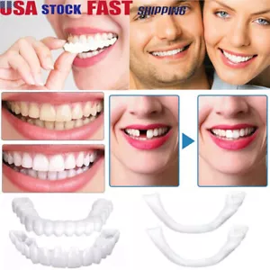 Snap On Upper&Bottom Set False Teeth Denture Veneers Dental Tooth Cover - Picture 1 of 11