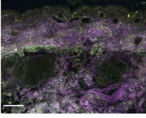 PHLOXINE B for microscopy || CAS: 18472-87-2 || 5 g to 100 g || Dye: +90% - Picture 1 of 4