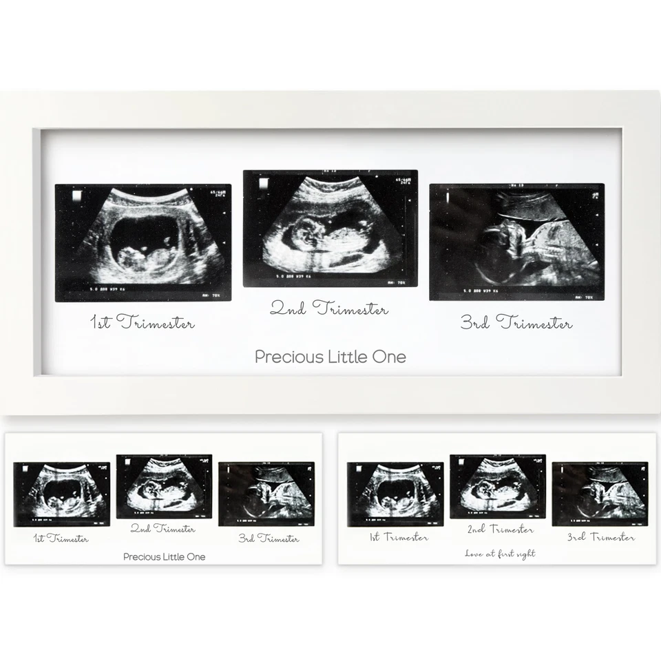 Keababies Baby Sonogram Picture Frames - Trio Ultrasound Pic