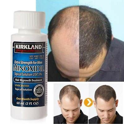 Kirkland Signature 5% Extra Strength For Men Hair Regrowth Treatment - Solution • 12.89£