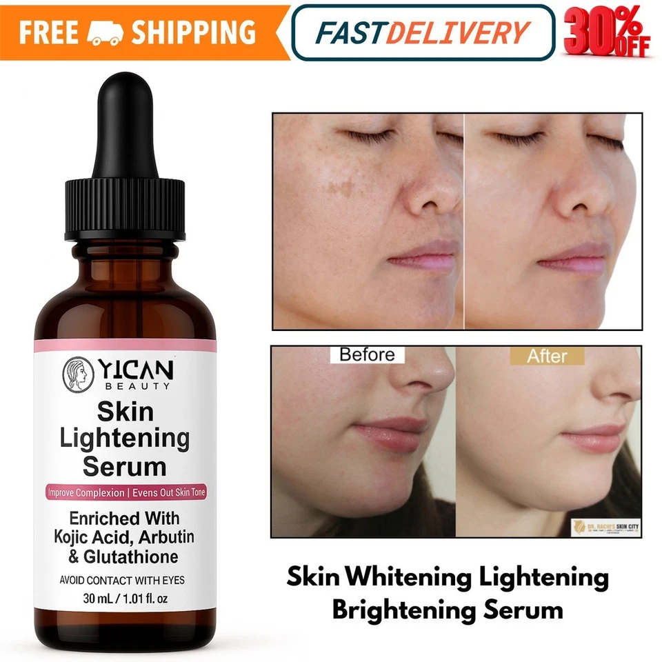 KOJIC ACID Skin Whitening Lightening Brightening Serum Bleaching/Spot Fade Cream - Image 1 of 4