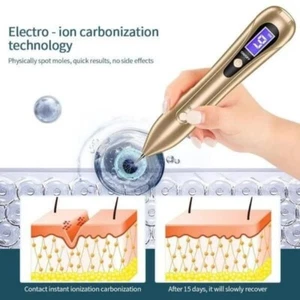 9 Levels Electric Laser Plasma Pen Dark Spot Skin Tag Tattoo Mole Remove Device - Picture 1 of 15