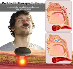 NUEVO Dispositivo Portátil de Alivio de Rinitis, Terapia de Luz Roja para Sinusitis Narices Nasales - Imagen 1 de 10